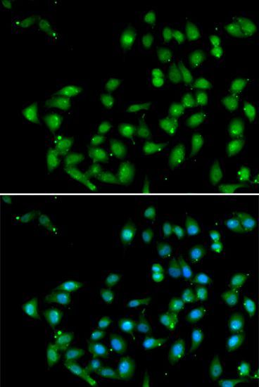 Immunofluorescence - CTNNBL1 antibody (144-06572)