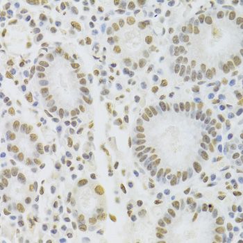 Immunohistochemistry - HNRNPD Polyclonal Antibody (144-01828)