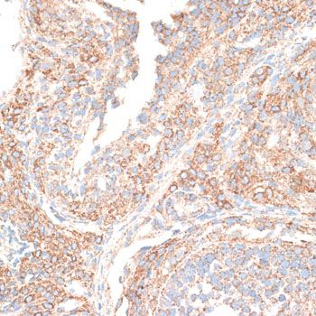 Immunohistochemistry - KIF14 Polyclonal Antibody (144-10275)
