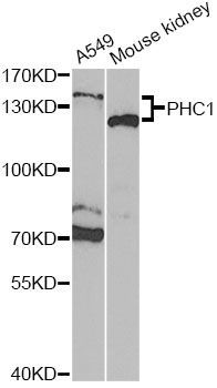 Western blot - PHC1 Antibody (144-05843)