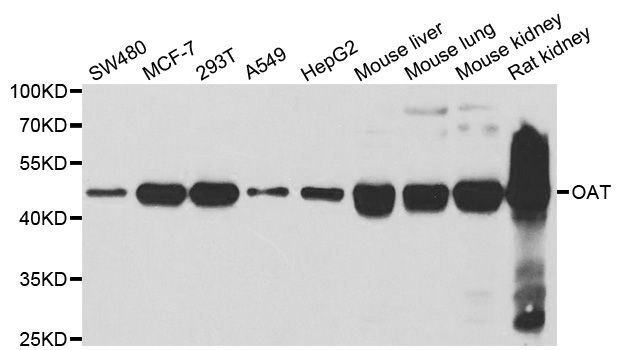 Western blot - OAT Polyclonal Antibody (144-06235)