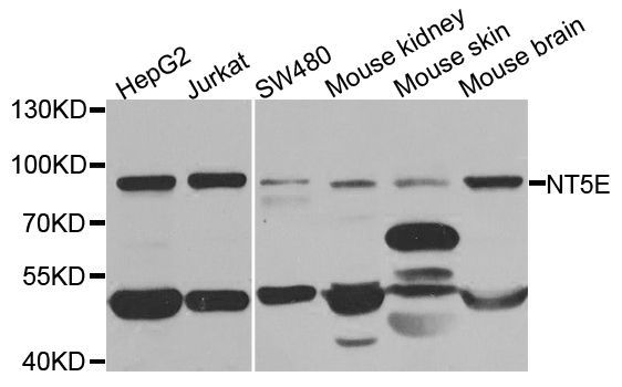 Western blot - NT5E antibody (144-02029)