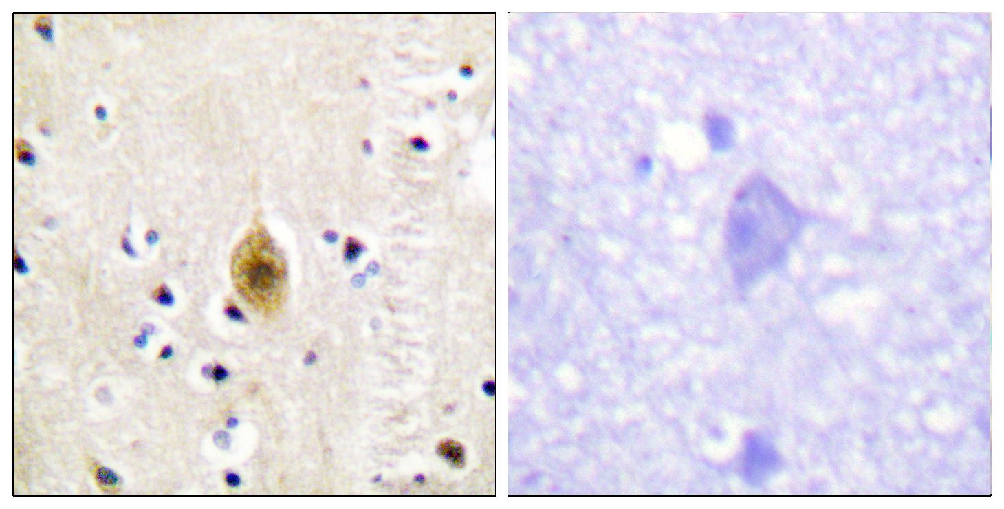 IHC