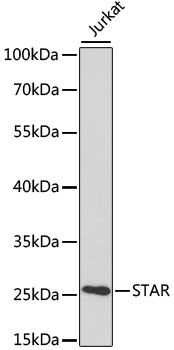 Western blot - STAR Polyclonal Antibody (144-60053)