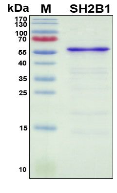 SDS-PAGE