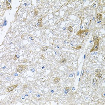 Immunohistochemistry - RAPSN antibody (144-06716)