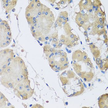 Immunohistochemistry - RPLP1 Polyclonal Antibody (144-06725)