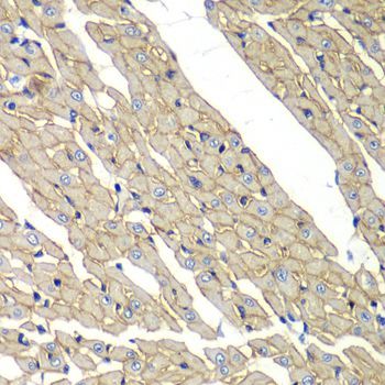 Immunohistochemistry - SGCD antibody (144-06980)