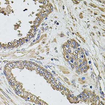Immunohistochemistry - KCNK9 antibody (144-08609)