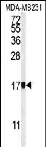 WB