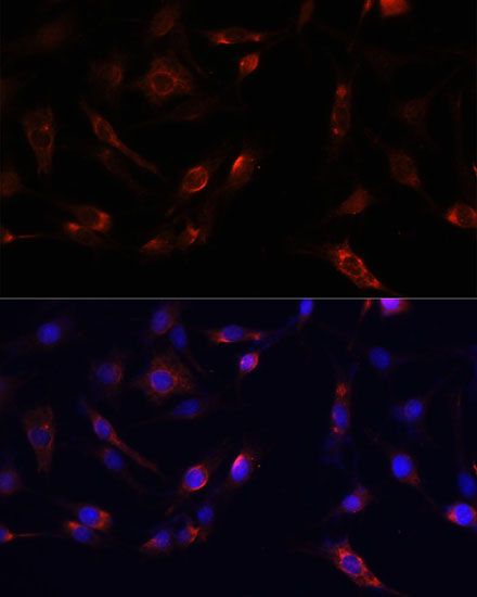 Immunofluorescence - PTK2 Polyclonal Antibody (144-60065)