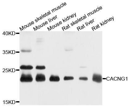 Western blot - CACNG1 Polyclonal Antibody (144-010014)