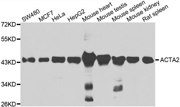 Western blot - ACTA2 antibody (144-07248)
