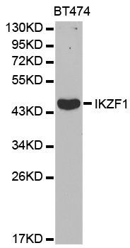 Western blot - IKZF1 Polyclonal Antibody (144-01850)