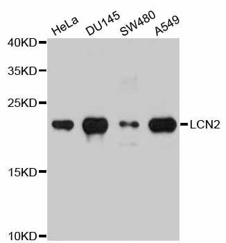 Western blot - LCN2 Polyclonal Antibody (144-02092)