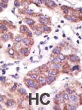 IHC-P