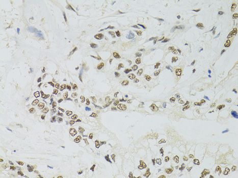 Immunohistochemistry - PPP4C Polyclonal Antibody (144-02109)