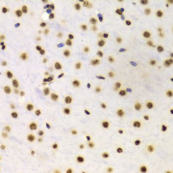 Immunohistochemistry - DiMethyl-Histone H3-K4 pAb (144-61340)