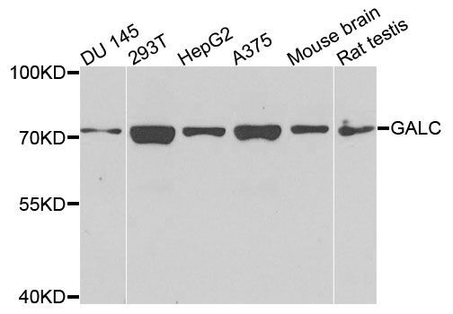 Western blot - GALC antibody (144-03873)