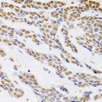 Immunohistochemistry - HDGF Antibody (144-05347)
