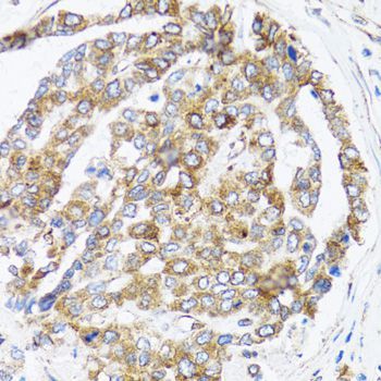 Immunohistochemistry - BCAP29 Polyclonal Antibody (144-06335)