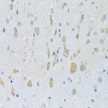 Immunohistochemistry - MAP2K5 Polyclonal Antibody (144-06953)