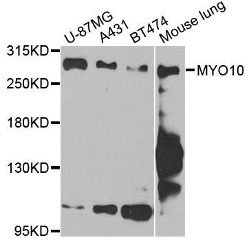 Western blot - MYO10 antibody (144-12466)
