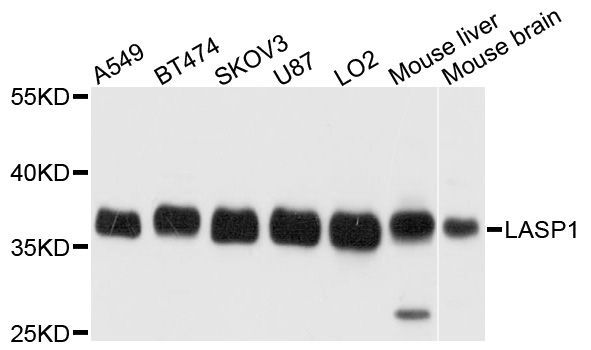 Western blot - LASP1 antibody (144-03941)