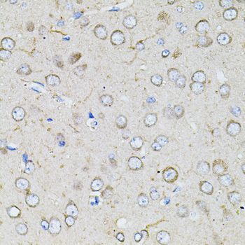 Immunohistochemistry - BEST1 antibody (144-03022)