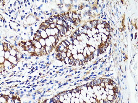 Immunohistochemistry - S100A10 antibody (144-60742)