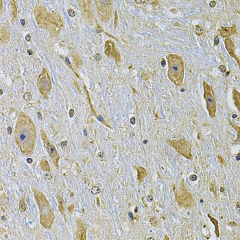 Immunohistochemistry - [KO Validated] ITGA2 Polyclonal Antibody (144-07629)