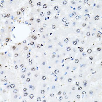 Immunohistochemistry - HIST2H2BE antibody (144-01958)