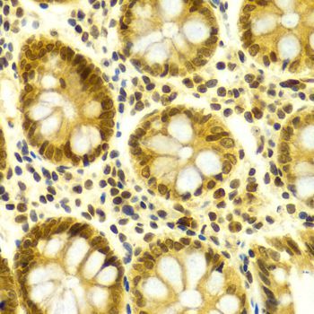 Immunohistochemistry - ELAVL1 Polyclonal Antibody (144-01608)