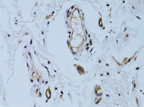 Immunohistochemistry - MCAM antibody (144-60521)