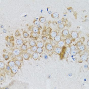 Immunohistochemistry - SIAH1 antibody (144-02494)