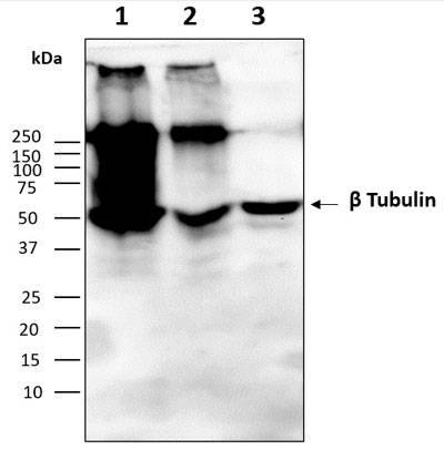 Western blot image
