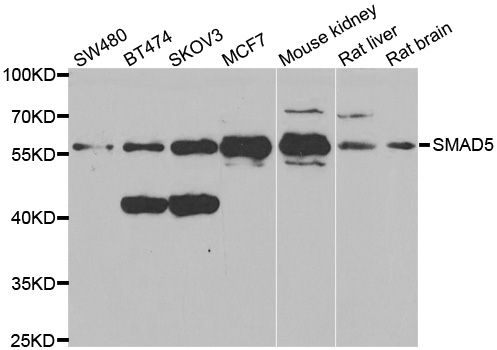 Western blot - SMAD5 antibody (144-01947)