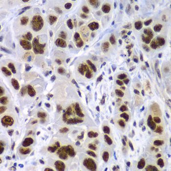 Immunohistochemistry - SF3B2 Polyclonal Antibody (144-05875)