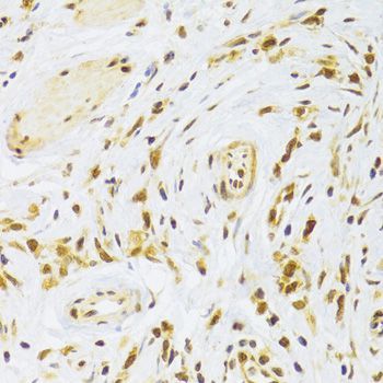 Immunohistochemistry - RPL13 Polyclonal Antibody (144-06723)