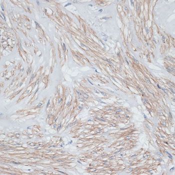 Immunohistochemistry - TPM1 antibody (144-01157)