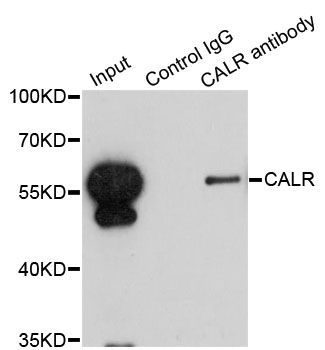 Immunoprecipitation - CALR Polyclonal Antibody (144-01066)