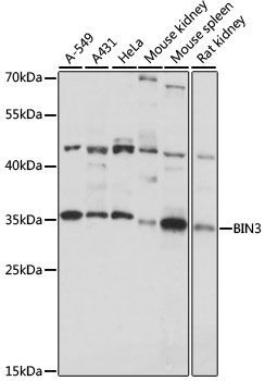 Western blot - BIN3 antibody (144-61075)