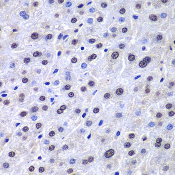 Immunohistochemistry - APEX1 antibody (144-01117)
