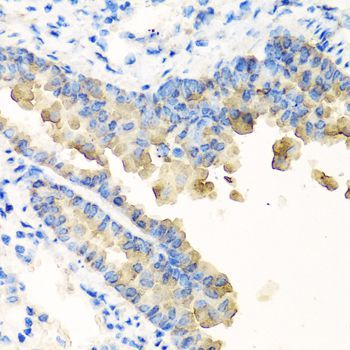 Immunohistochemistry - NYX antibody (144-07830)