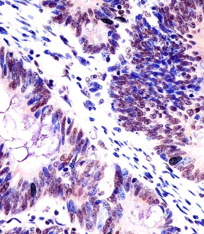 IHC-P