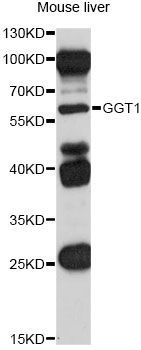 Western blot - GGT1 antibody (144-01776)