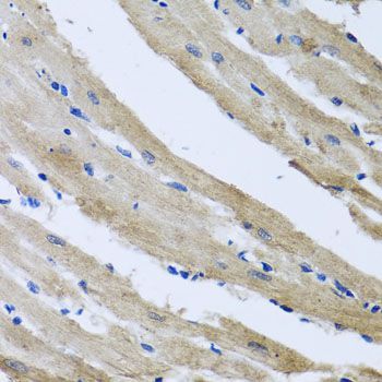 Immunohistochemistry - ST8SIA2 antibody (144-07748)