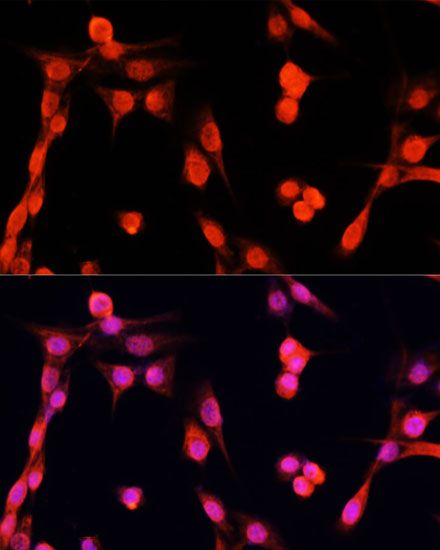 Immunofluorescence - EGFR Polyclonal Antibody (144-011577)