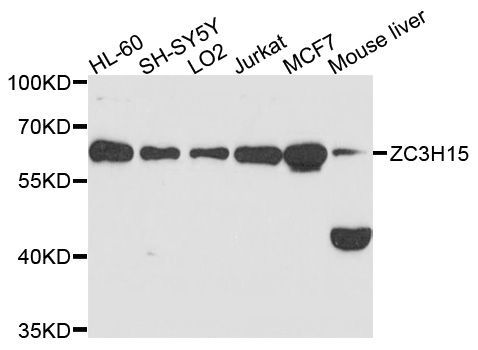 Western blot - ZC3H15 Polyclonal Antibody (144-010045)