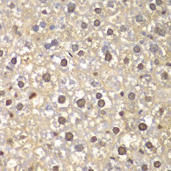 Immunohistochemistry - FEN1 Polyclonal Antibody (144-01175)
